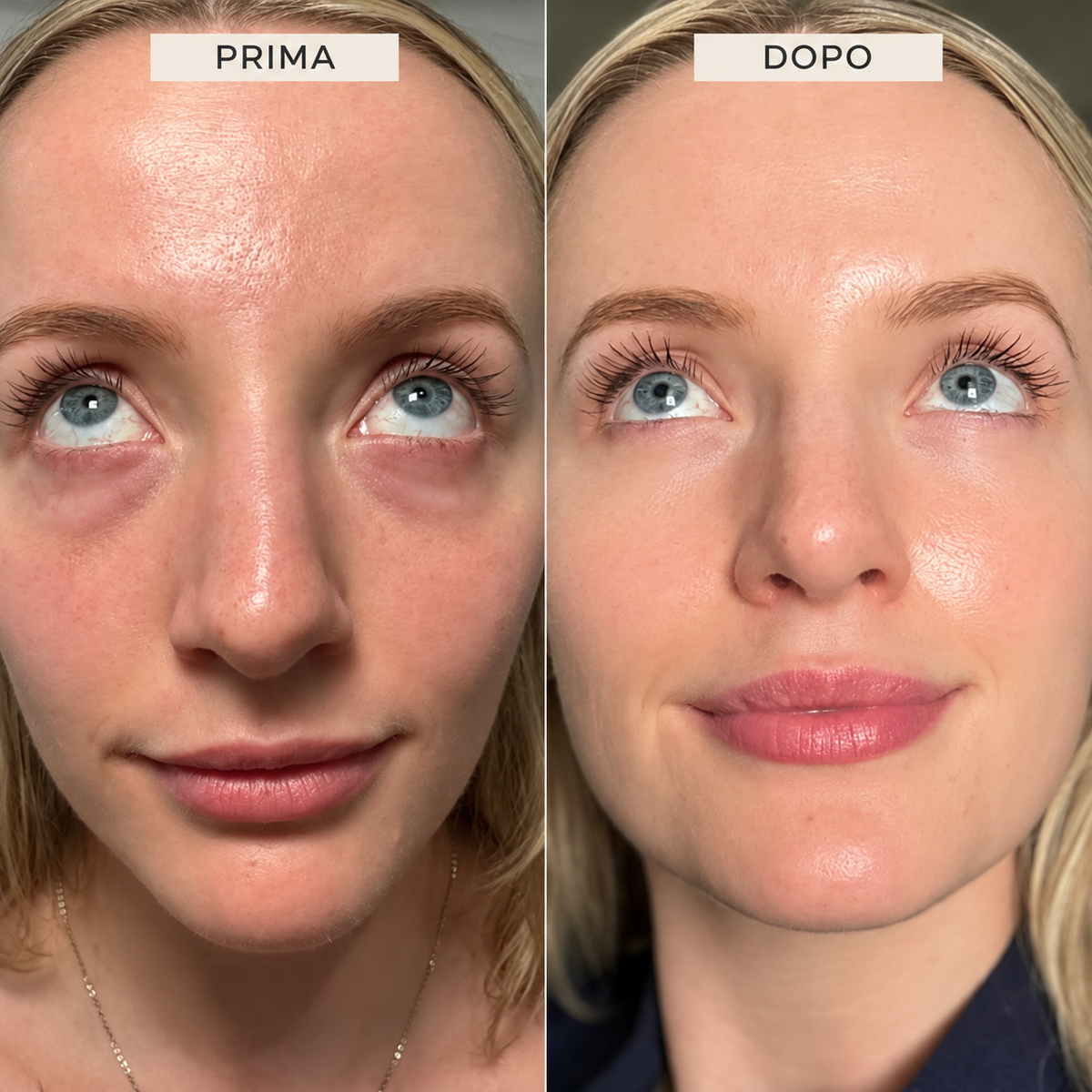LumiEyes™ | Gel Contorno Occhi Illuminante e Idratante
